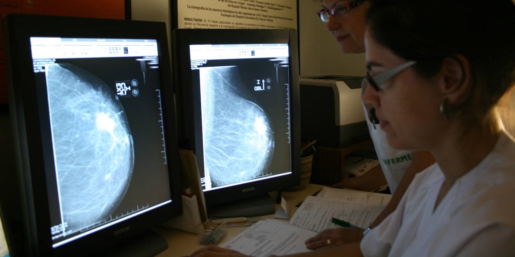 descubre información actualizada sobre los retrasos en el diagnóstico y tratamiento del cáncer de mama en andalucía, analizando causas, consecuencias y posibles soluciones para mejorar la atención sanitaria.